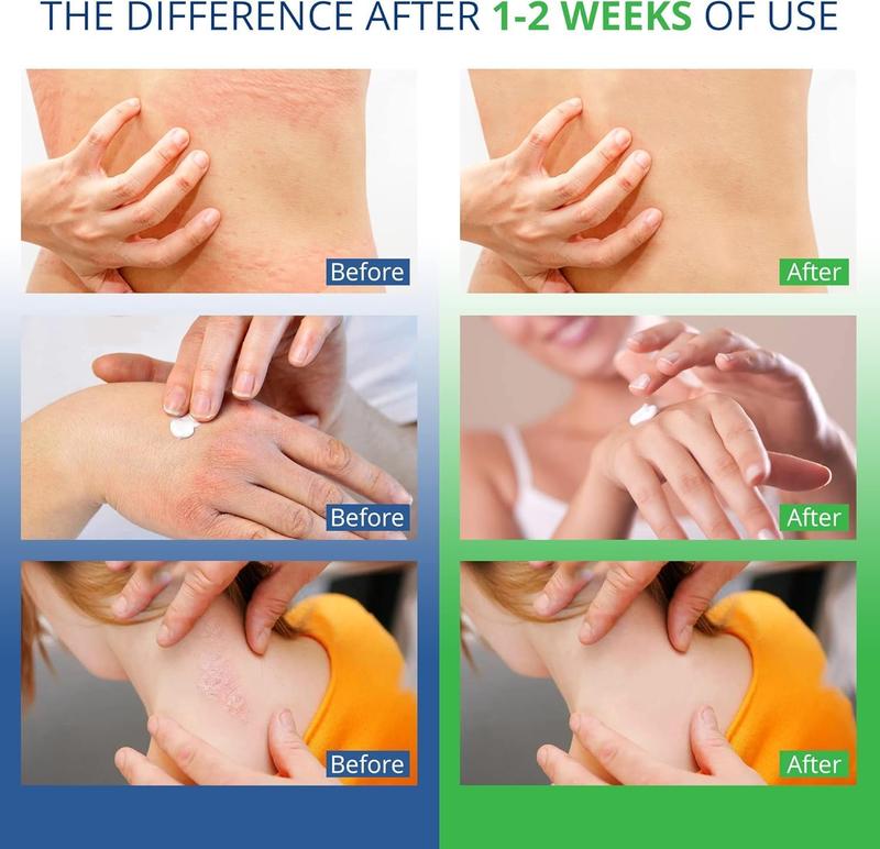 https://cdn-01.yolobuyer.com/products/1729743076619817677/pics/31f1d2d40ce8468ca705a3dd2ec06e18.jpeg